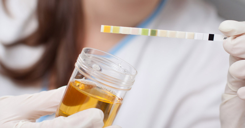 Omeopatia e apparato urinario