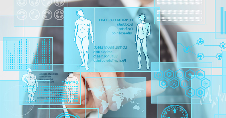 Costituzioni omeopatiche del longilineo