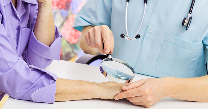 Psoriasi in donna di cinquantasetteanni