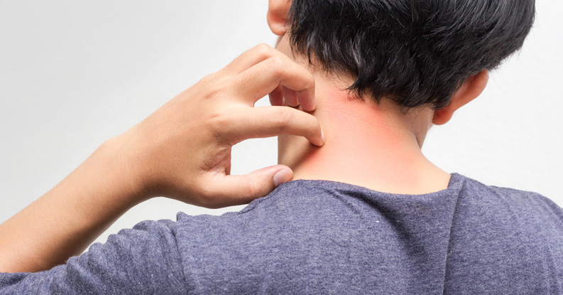 Caso clinico omeopatico di artrite psoriasica